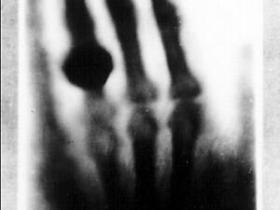 X射线发现者伦琴逝世_大学