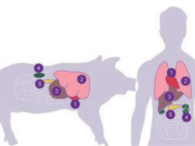 人类永生不是梦 最新研究猪肾成功植入人体